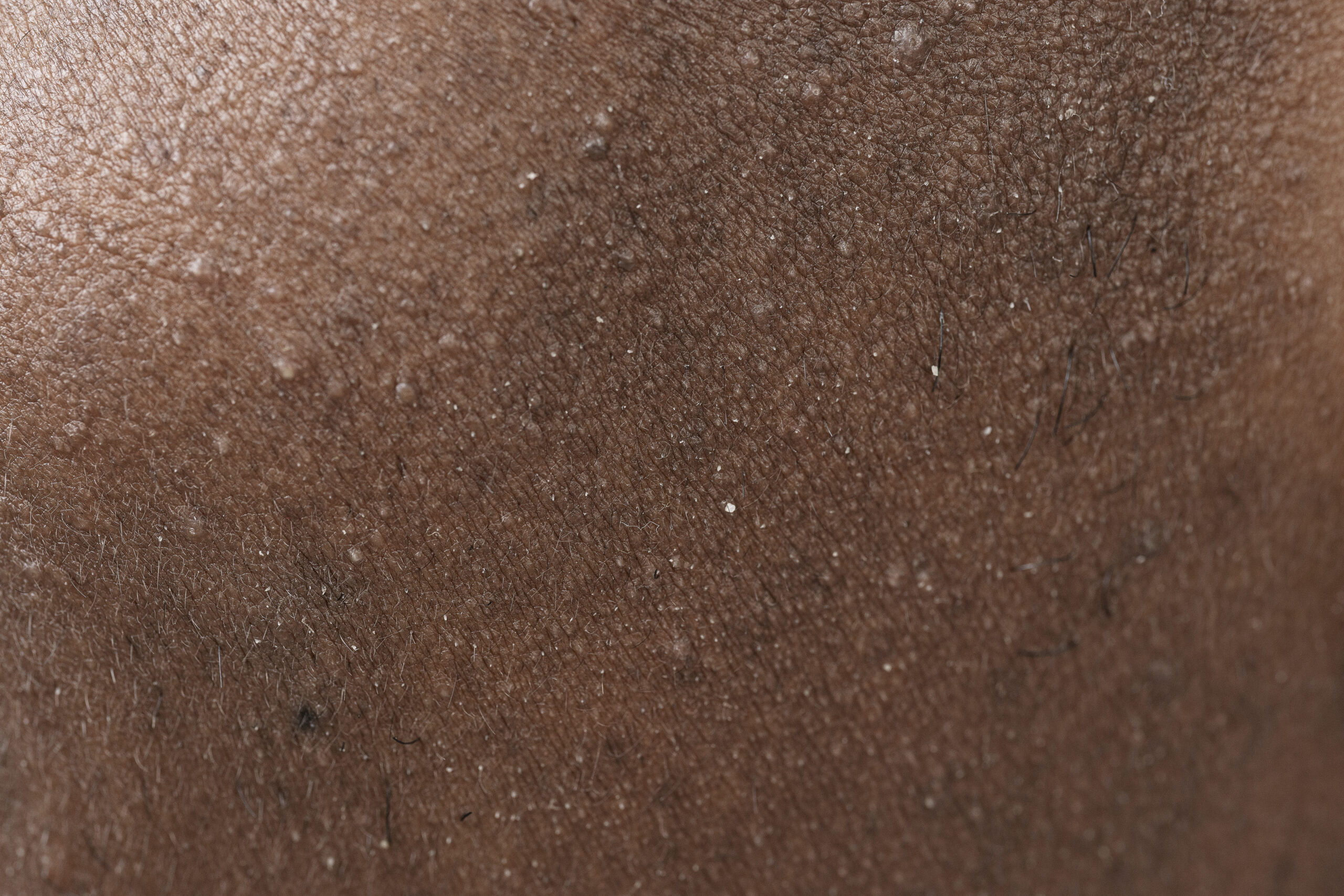 close up skin pores face care routine